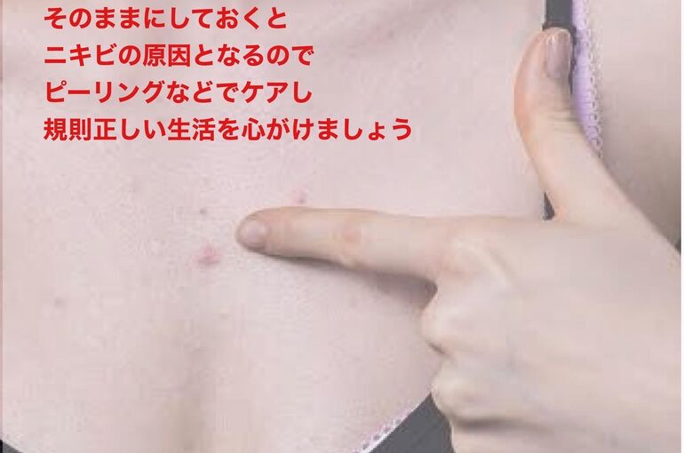 20935EF1-EFA8-4A05-BB20-C461469359D7